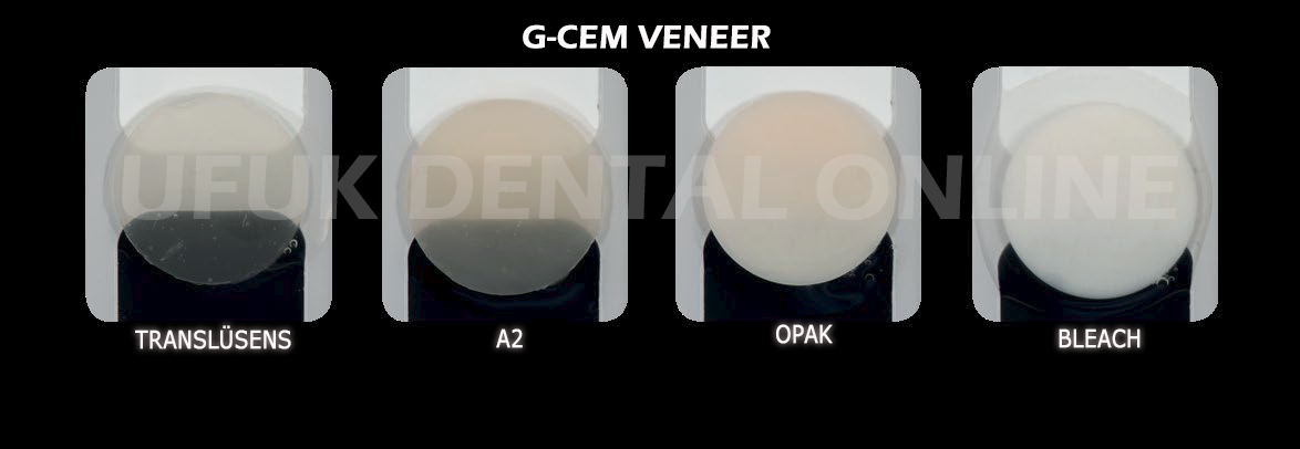 Veneer_renk