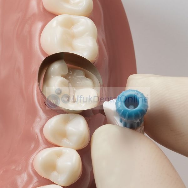 Palodent 360 Matrix sistem | Çevresel matrix