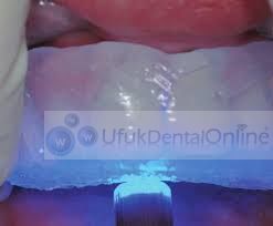Elite Glass | Şeffaf Silikon