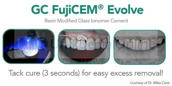 Fujicem Evolve Rezin Modifiye Cam İyonomer Siman