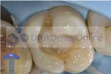 Essentia Masking Liner Opaker