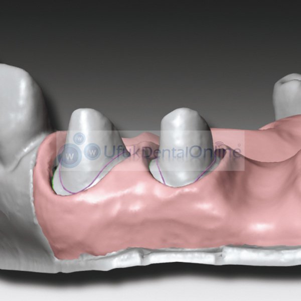 Zhermack Gingifast Cad Elastic (Yumuşak)